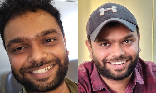 Advanced Cosmetic Dentistry