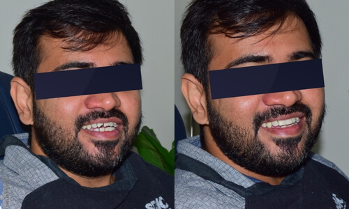 Advanced Cosmetic Dentistry