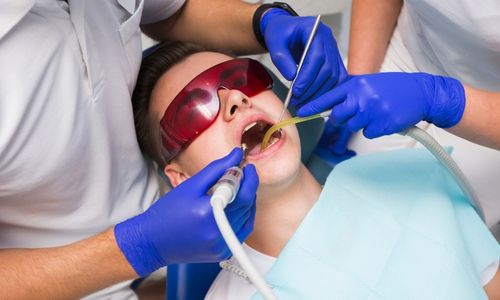 Re-treatment of Root Canal