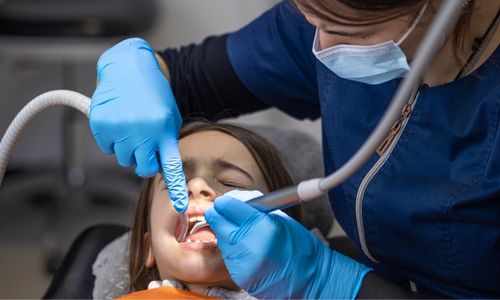 Advanced Root Canal Treatment