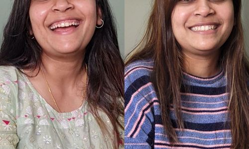 Treatment of Gum Disease