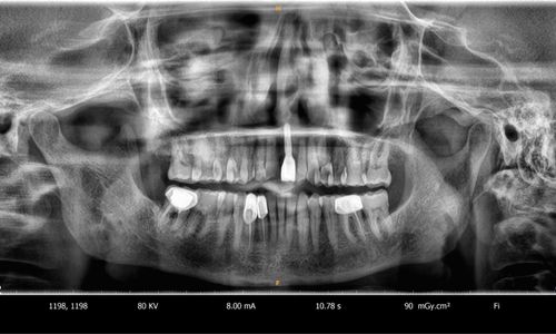 Digital X-ray & OPG