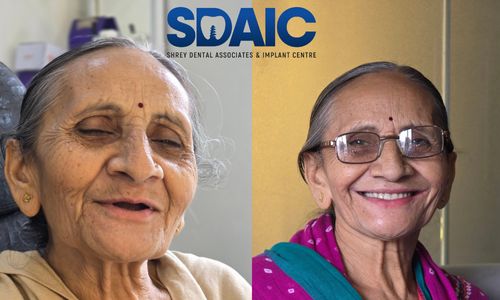 Full Mouth Rehabilitation