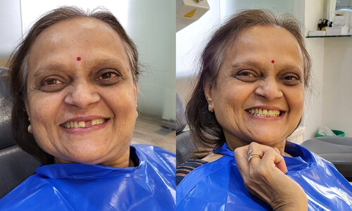 Advanced Implantology